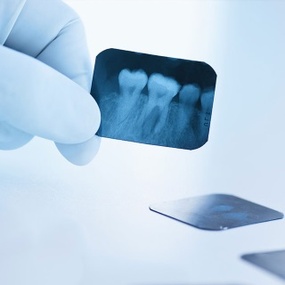 Рентгенографическое обследование Рентгенографическое обследование