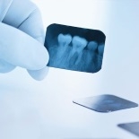 Рентгенографическое обследование 