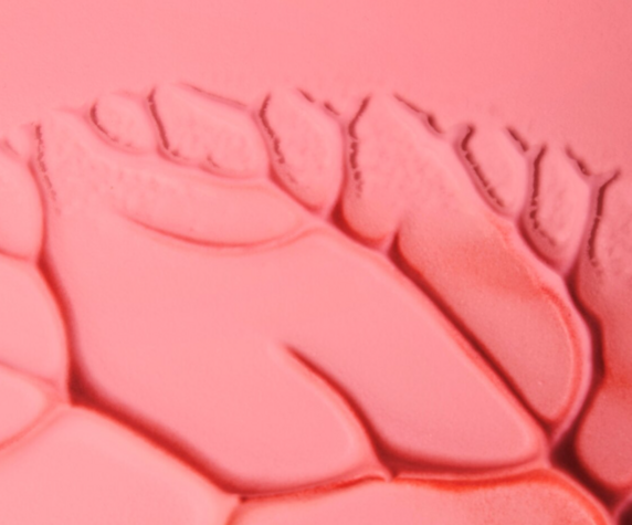 Почему возникает диабетическая язва?