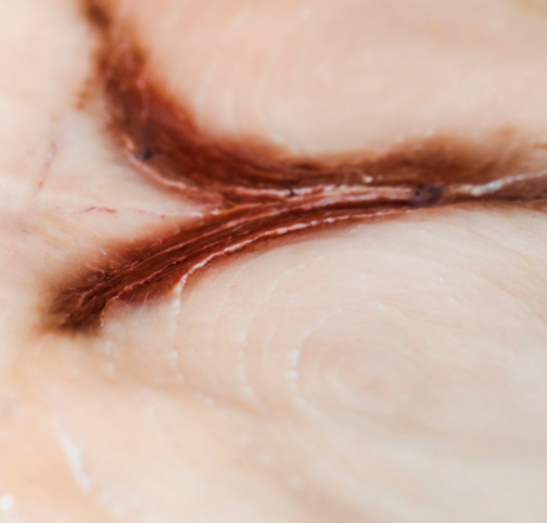 Признаки нормального заживления и тревожные симптомы