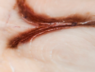 Признаки нормального заживления и тревожные симптомы