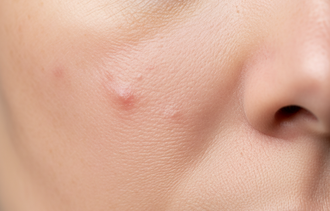 вопросы по глутатиону