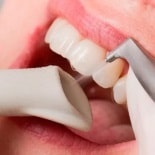 Профессиональная гигиена полости рта