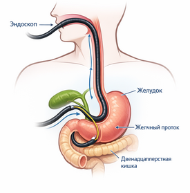 биопсия печени для поиска причин холестаза