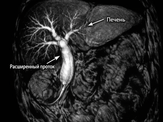 Инструментальные методы холестаза
