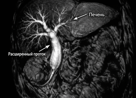 Инструментальные методы холестаза
