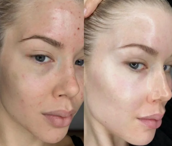 Рекомендации по курсу, дозировке и мониторингу эффективности