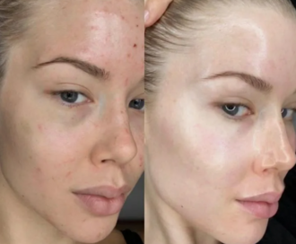 Рекомендации по курсу, дозировке и мониторингу эффективности