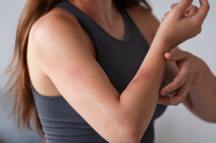 Что такое зуд при холестазе?