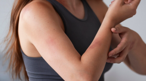 Что такое зуд при холестазе?