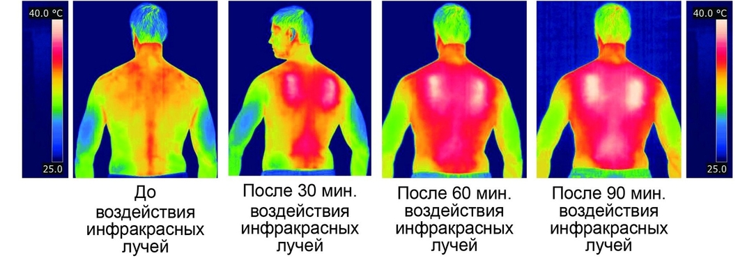 Принцип работы греющего комплекта