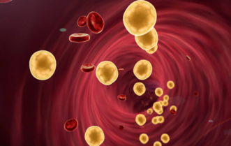 Как снизить плохой холестерин без статинов