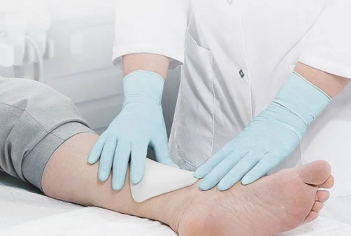 Эффективное лечение диабетической язвы с помощью мази Ируксол