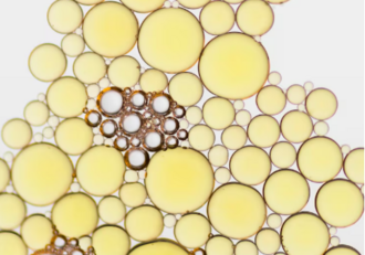 Холестерин ЛПНП низкой плотности