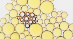 Холестерин ЛПНП низкой плотности: норма в крови, причины, диагностика