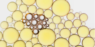 Холестерин ЛПНП низкой плотности: норма в крови, причины, диагностика