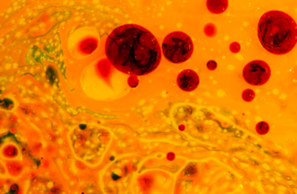 Какую диету нужно соблюдать для снижения плохого холестерина