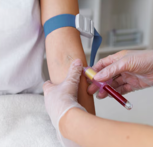 Процедура забора крови на холестерин