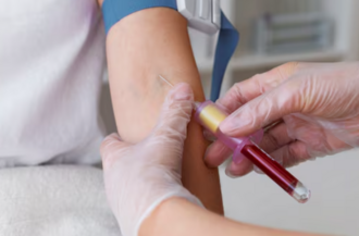 Процедура забора крови на холестерин