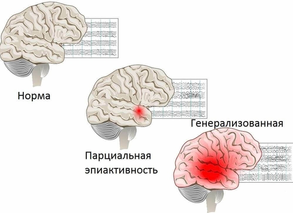 Медицинское сопровождение при лечении Сабрилом
