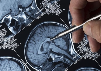 Осполот ингибирует судороги, доставка по городу