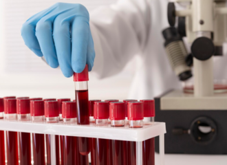  Диагностика непереносимости статинов: как подтвердить проблему