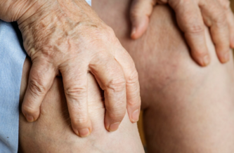 Лечение варикозных язв