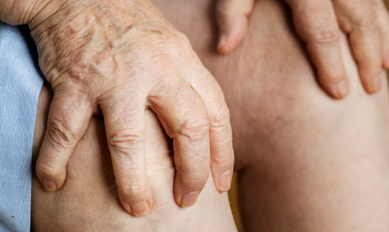 Лечение варикозных язв 