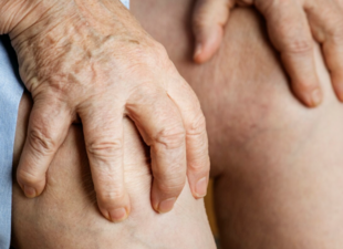 Лечение варикозных язв