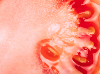 Основные причины трофической язвы и ее лечение