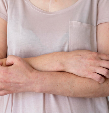 Холестирамин и диета: влияние питания на эффективность препарата при кожном зуде