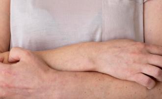 Холестирамин и диета: влияние питания на эффективность препарата при кожном зуде