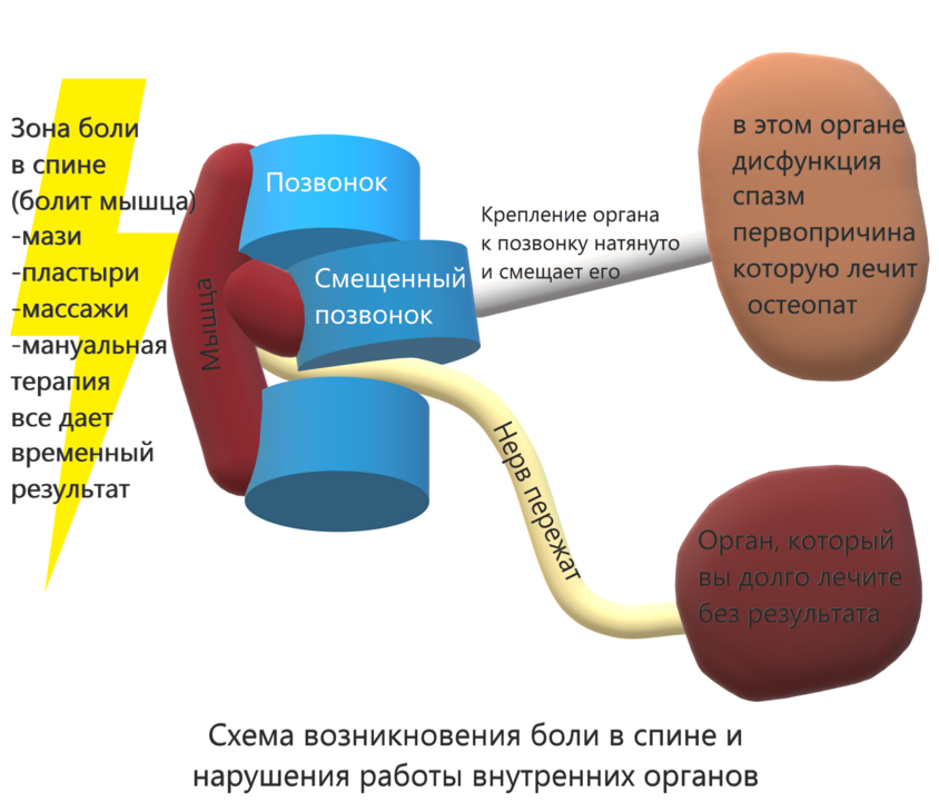 Схема возникновения боли в спине и нарушения работы внутренних органов