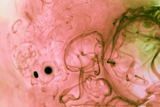  Механизмы нарушения оттока желчи