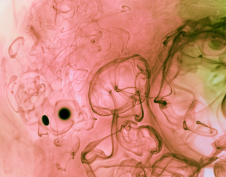  Механизмы нарушения оттока желчи