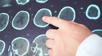 Профиль препарата Суксилеп для беременных