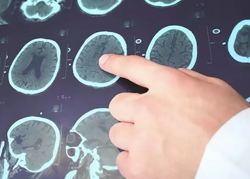 Как курение влияет на частоту эпилептических приступов