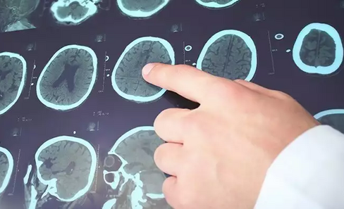 Профиль препарата Суксилеп для беременных