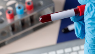 Регулярно контролировать холестерин