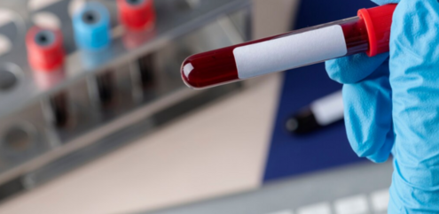 Регулярно контролировать холестерин