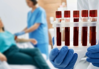 подготовка к внутривенному курсу глутатионом