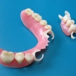 Частично-съёмные пластиночные протезы